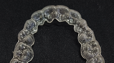 vinayaga dental lab Splint-vinayaga dental lab